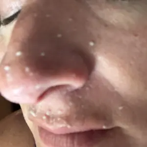 Product Review of [Dr.Melaxin Official] Peel Shot Glow Rice Ampoule Duo - Serums for Brightening, Exfoliating, and Moisturizing - Suitable for All Skin Types from L**💗