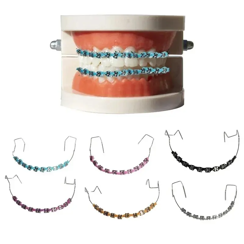 1-Pair Fashion Orthodontic Oral Teeth Accessories, Colorful Temporary Dental Kit with Metal Wires, Metal Brackets, Ligature Ties, Low Irritation, Precise Groove Design, High Quality, Easy Placement