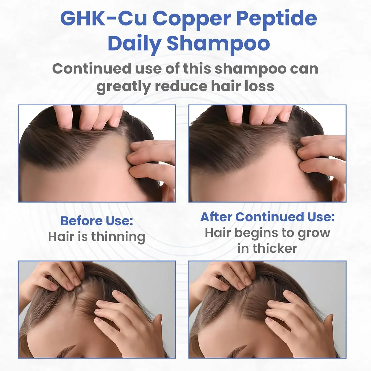 GHK-Cu Copper Peptide Shampoo - Anti Hair Loss Shampoo - Promotes New Hair Growth, 11.8 Fluid Ounce - TikTok Shop GHK-Cu Copper Peptide Shampoo - Anti Hair Loss Shampoo - Promotes New Hair Growth, 11.8 Fluid Ounce - TikTok Shop