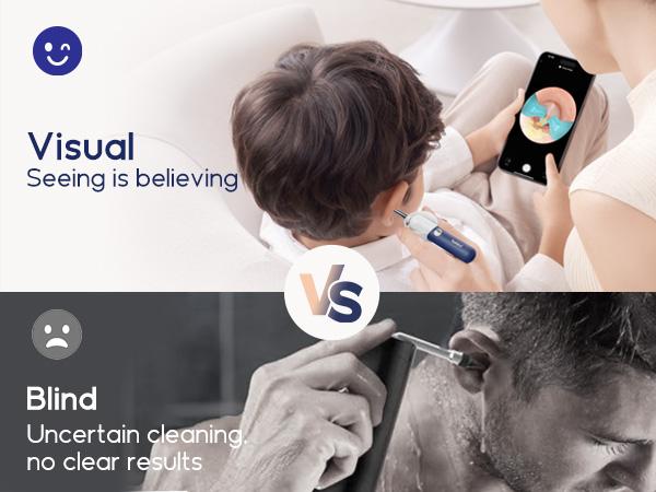 Ear Wax Removal Tool Camera, Flexible Wireless Ear Cleaner with Camera Otoscope Light, HD Painless Visual Ear Picker Tweezers Earwax Remover, Portable Safe Ear Cleaning Kit for Adults & Kids