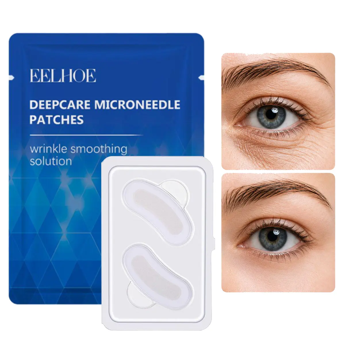 smgt-glp-1 nano microneedle patch