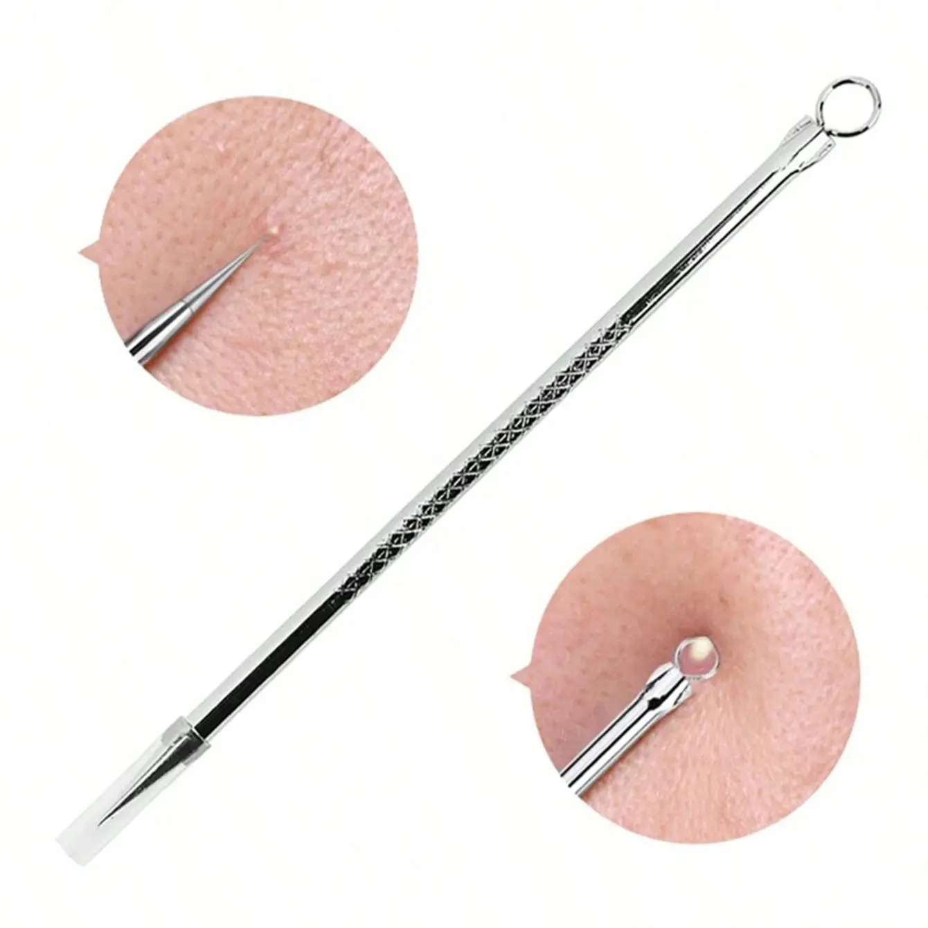 Stainless Steel Blackhead Remover Tool, Pimple Acne Needle for Blemish Removal, Odorless Skincare Accessory for Daily Use