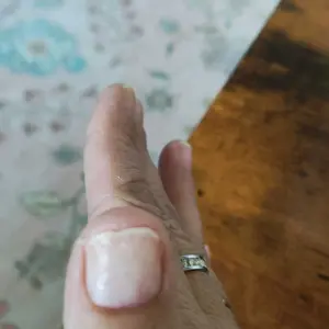 Product Review of Radiant Cosmetics Nail Growth Oil - 100% Organic, Moisturizing, Growth, Strengthening, and Brightening Formula with Vitamins and Fatty Acids for Overall Nail Health from P**h