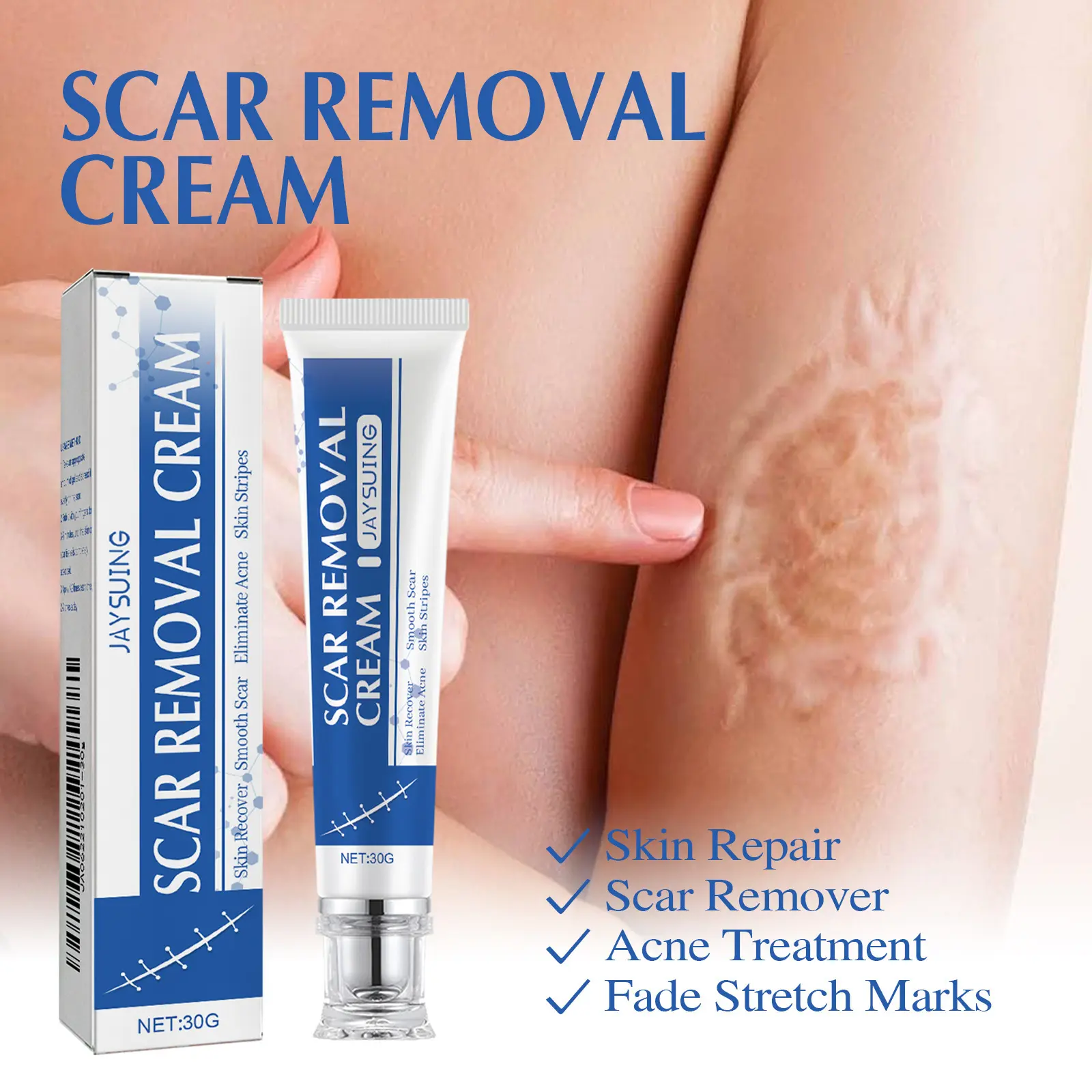 Mild Body Care Repair Cream, 30g Wash-Off Formula for Surgical Marks, Stretch Marks & Acne Blemishes, Reduces Imperfections for Even Complexion Lightweight Gentle Daily Smooth old scar removal cream