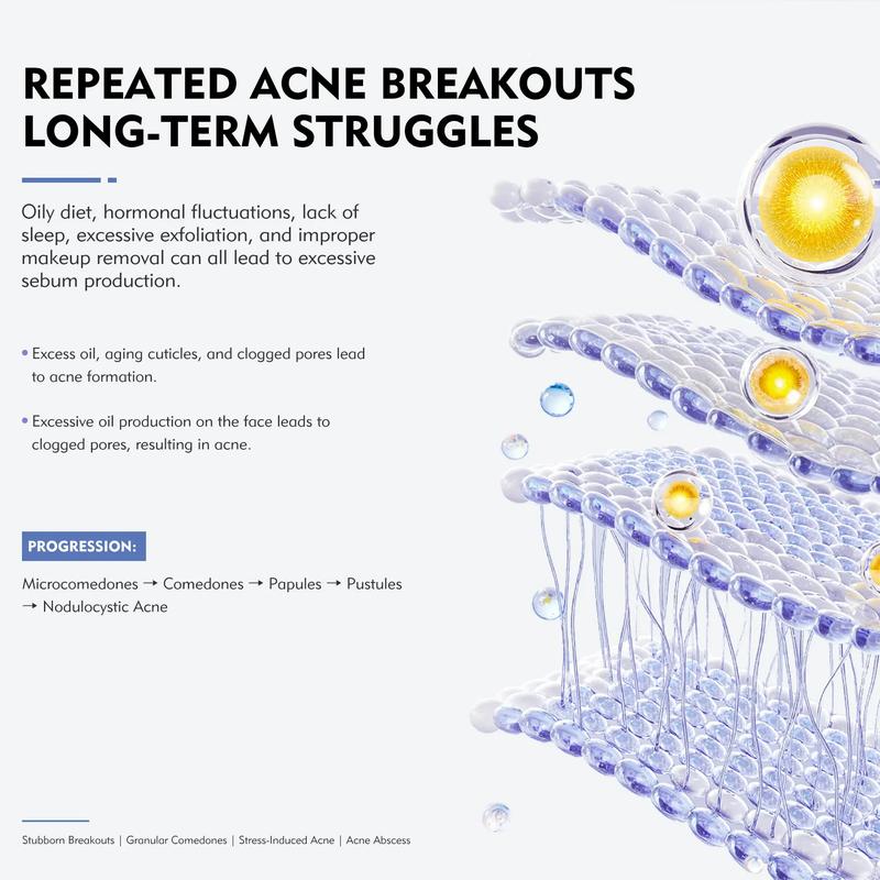 KOSHINÉ KX-826 Anti-Acne Gel | Advanced Skincare for Clearer, Balanced Skin Suitable for Men and Women(50ml))