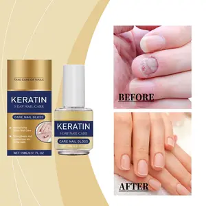 15ML Nourishing Nail Care Oil, Gentle Ingredients Moisturize & Shine Nails, Liquid Form, Single Item, No Flammable Aerosols, 24 Months, Nail Strengthener Oil