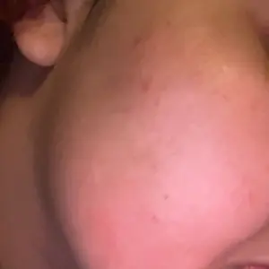 Product Review of [Dr.Melaxin Official] Peel Shot Glow Rice Ampoule Duo - Serums for Brightening, Exfoliating, and Moisturizing - Suitable for All Skin Types from K**m