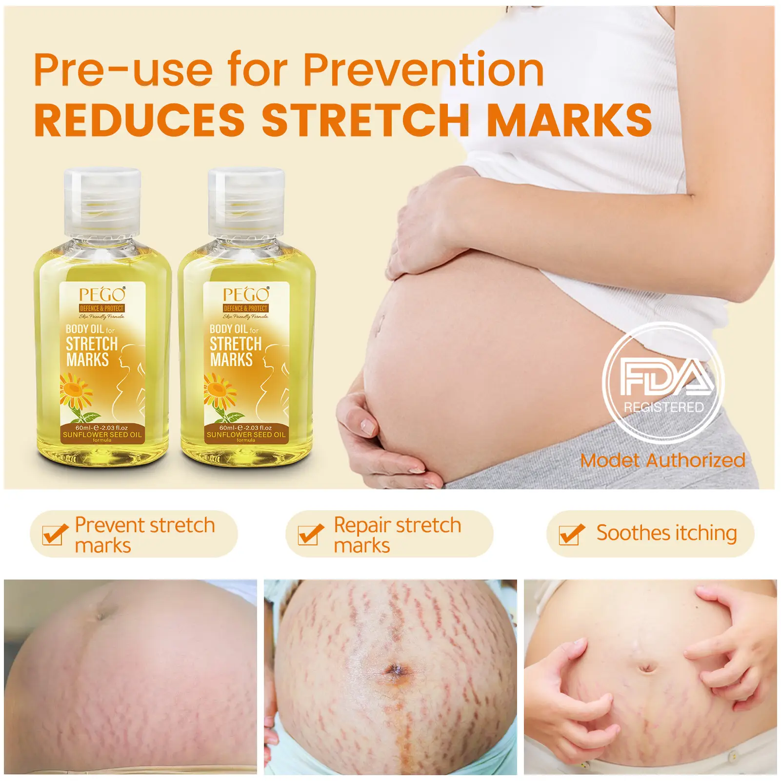 PEGO Stretch Mark Body Oil for Pregnancy, Natural, Safe, Stretch Marks for All Skin Types, Sunflower Seed Oil 2.03 oz, 2 pcs