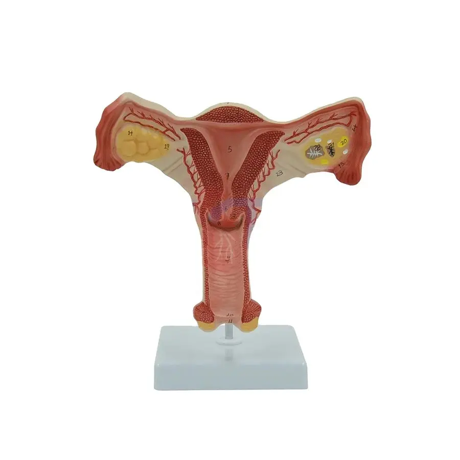 Life-Size Female Uterus Model: Educational Tool