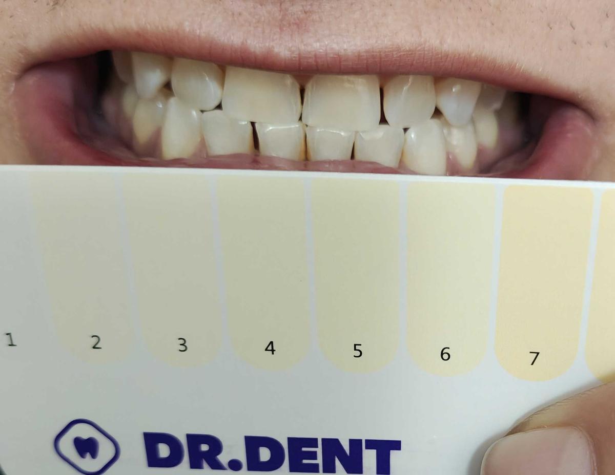 Item: 42 strips (21 sessions)