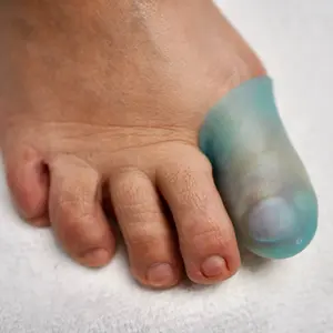 MediPediNYC+ Gel Toe Caps 5pcs – Stretchable, Washable, Reusable, Latex-Free, Unisex Toe Protectors | Keeps Nails Dry & Comfortable