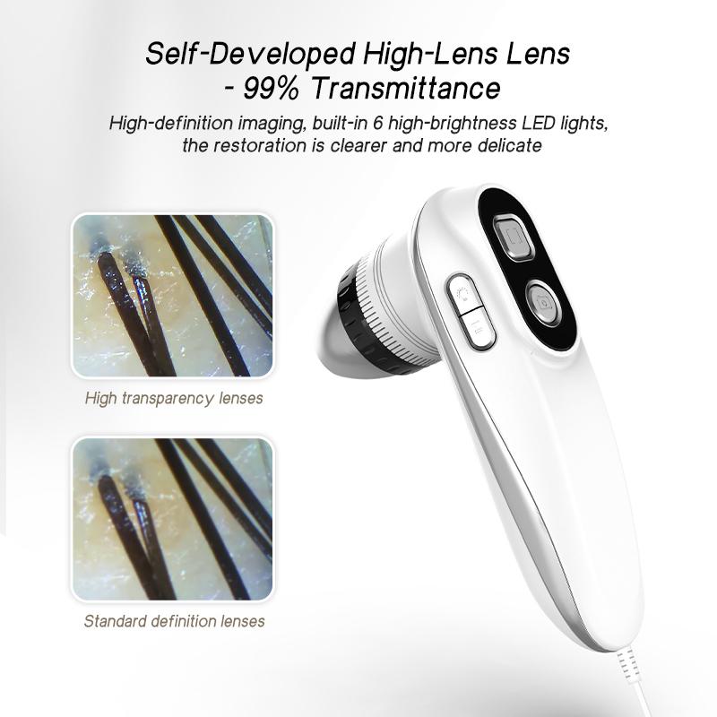 Meiboyi Classic HD Home Use Skin Analyzer Dual Lens 200X 50X Scalp Camera Skin Analysis Device Scalp Scanner Skin Detector