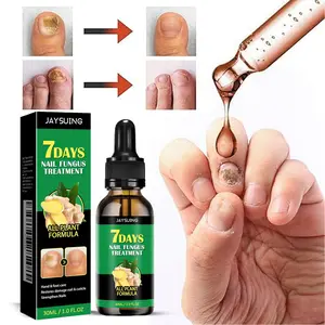 Nail Fungus Treatment - Soften Thick Nails Whiten Discolored Nails, Ginger Nail Treatment,Toe and Fingernail Support