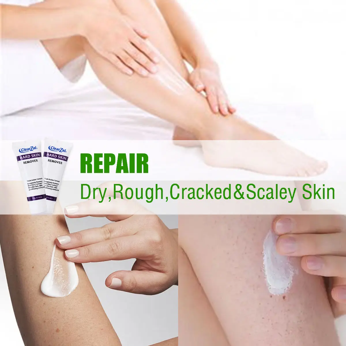 ClearZal targets chicken skin on arms and legs and enlarged pores,  improves it, and can be used all over the body Triple action formula exfoliates old skin cells 3.4 Ounce [Combination pack]