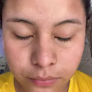 Product Review of Lion Pair Acne Cream Acne Treatment Pimples Removal Cream Pair Acne Creamy Foam Facial Wash Gentle Antibacterial from m**m