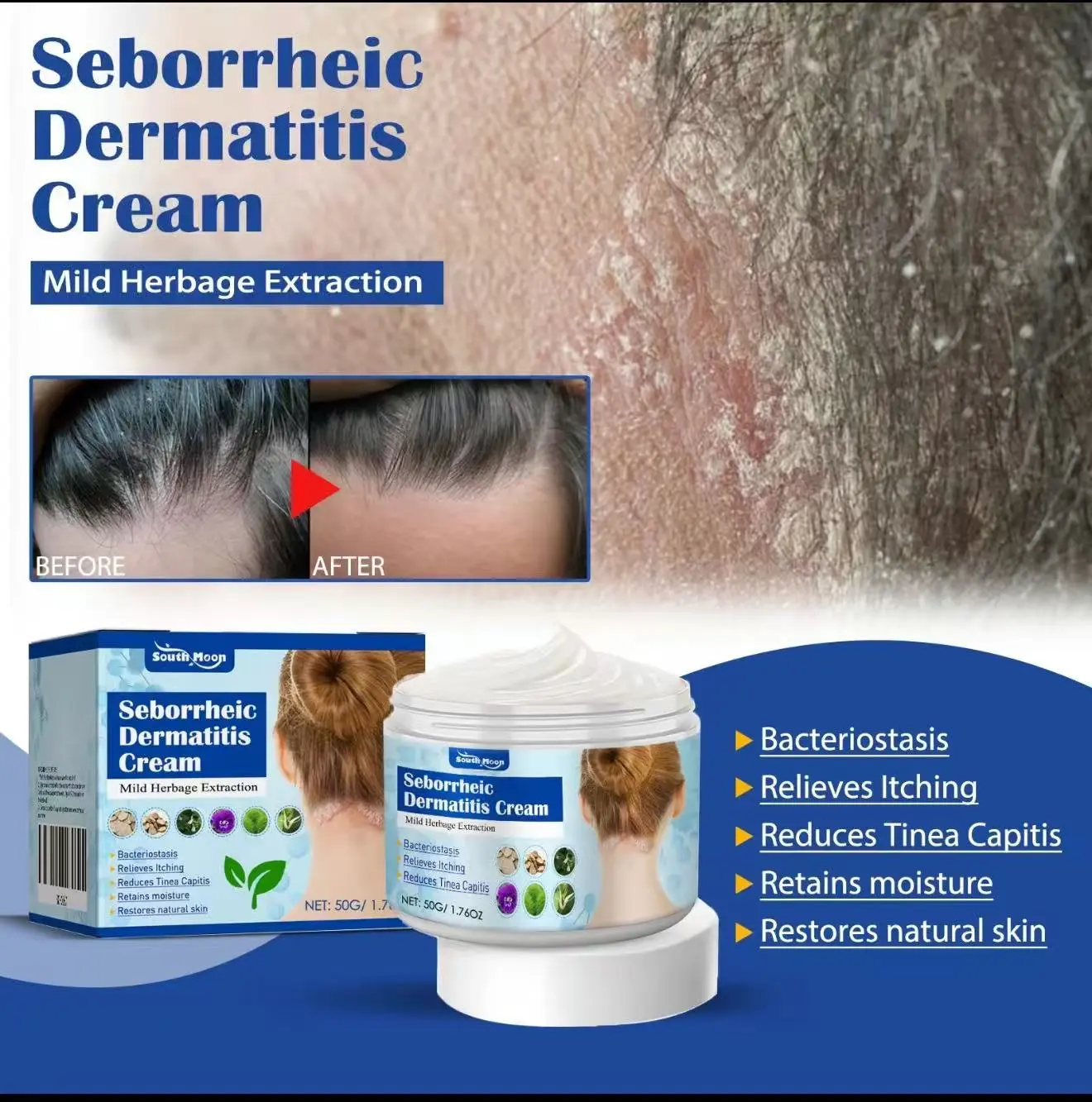Folliculitis Treatment Cream for Seborrheic Dermatitis, Soothing Herbal Haircare for Scalp, Face, and Body Repair - 50g, Herbal Blend, Scalp/Body/Facial, Repairing, Honeysuckle, Dandelion, Scalp/Body/Facel