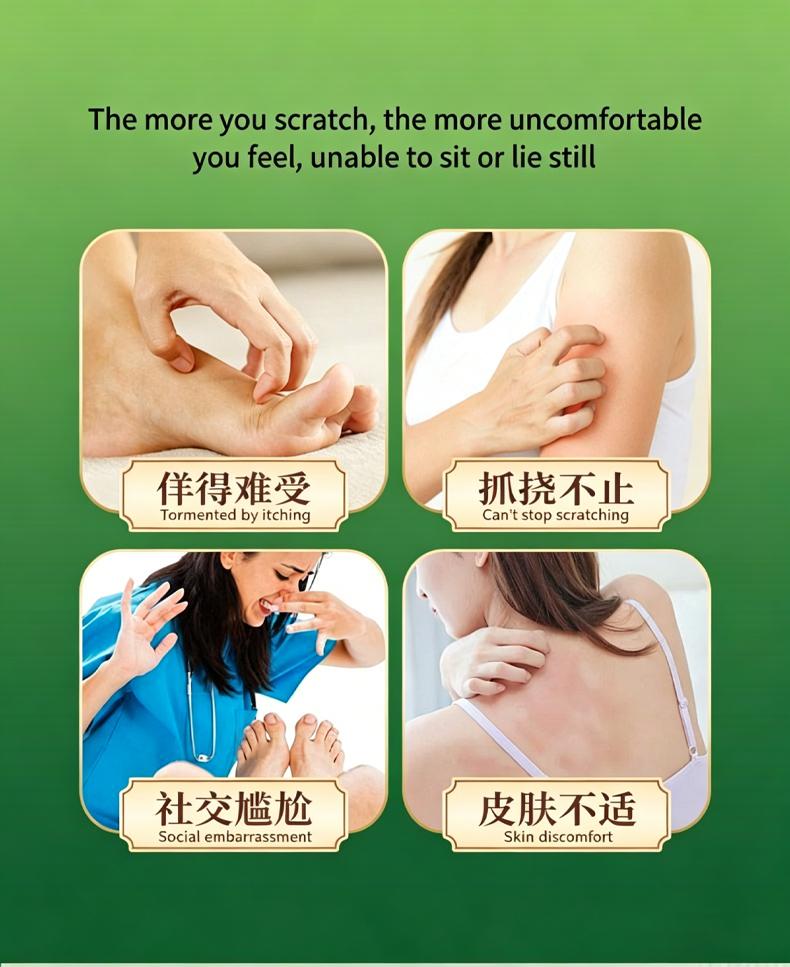 Fast Itch Relief CreamYunnan Herbal Skin Itch Relief CreamGenuine, for dry itching and wet itching all over the body,suitable for adults, children and the elderly.