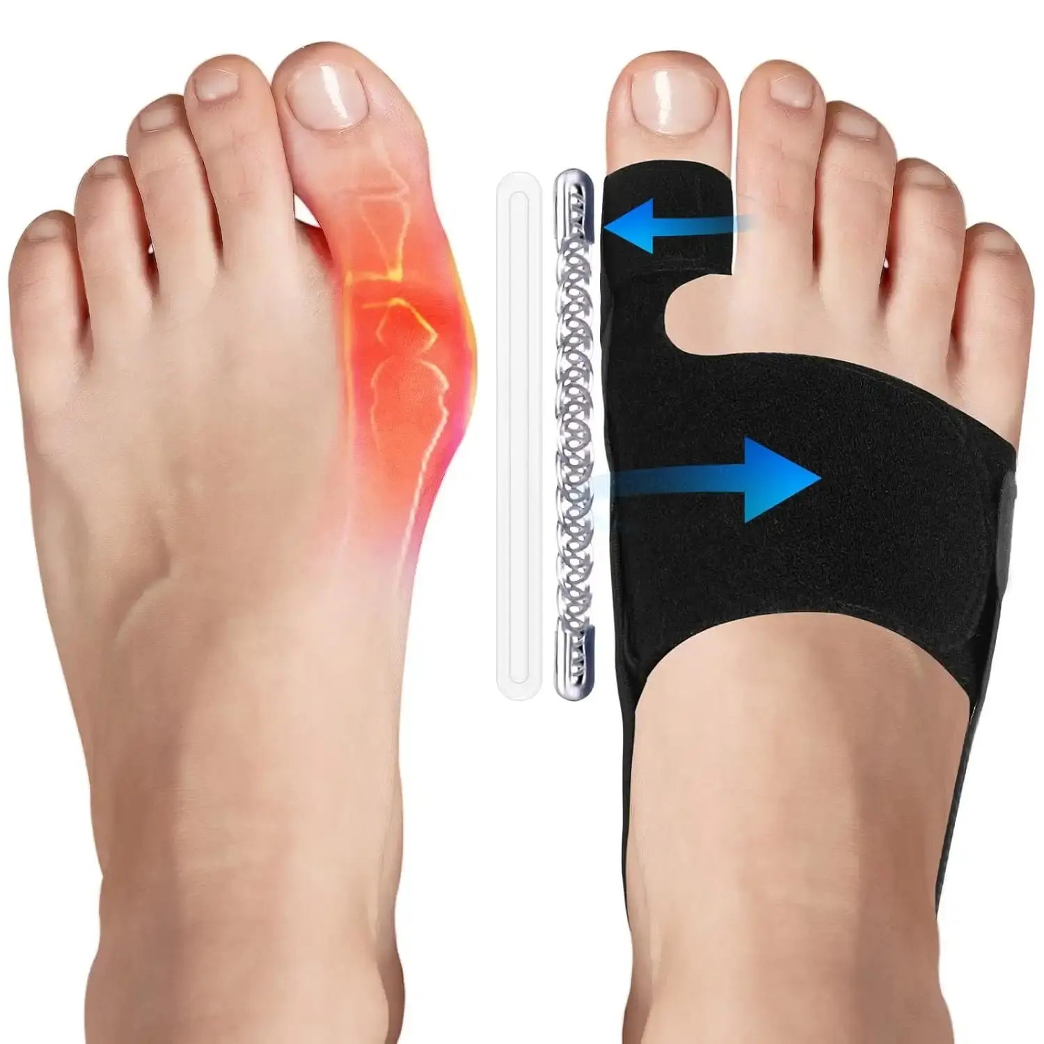 2 Pack Bunion Corrector for Men Women, Adjustable Breathable Brace Splint, Hallux Valgus Pain Relief, Day Night Support for Left & Right Foot