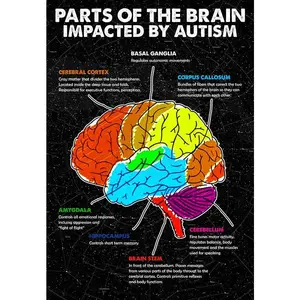 Decoration Room Parts Of The Brain Impacted by Autism Poster Wall Art Print