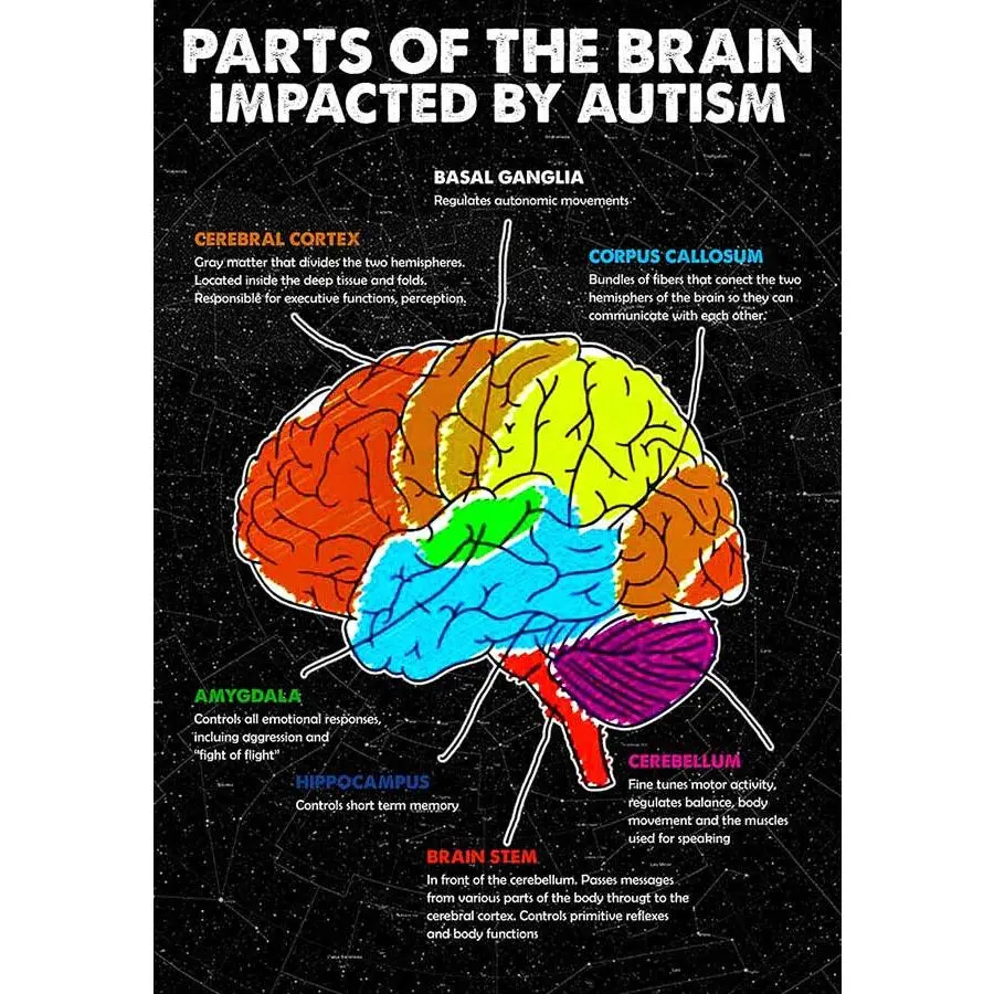 Decoration Room Parts Of The Brain Impacted by Autism Poster Wall Art Print
