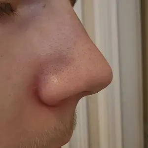 Product Review of [Dr.Melaxin Official] Peel Shot Glow Rice Ampoule Duo - Serums for Brightening, Exfoliating, and Moisturizing - Suitable for All Skin Types from s**h