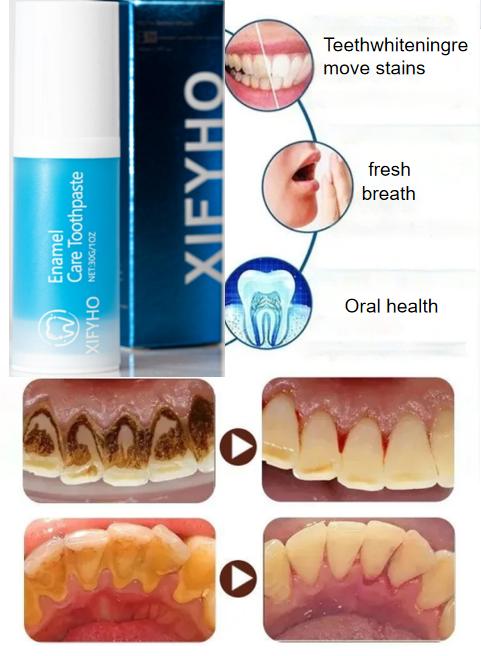 XIFYHO Cerulean blue Teeth Whitening Toothpaste, FreshenBreath Toothpaste for Oral Hygiene Clean,Daily Oral Health Care Cleansing Paste