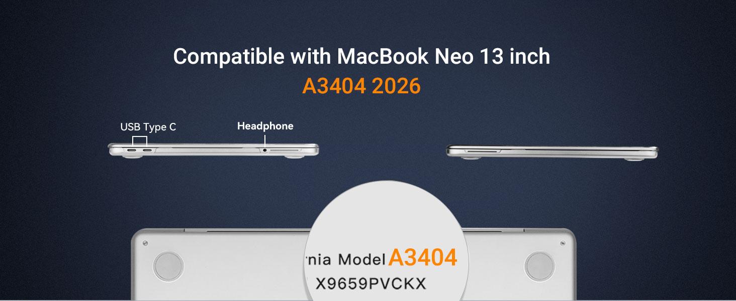 MOSISO Compatible with MacBook Neo Case 13 inch 2026 Release Model A3404, Precision-Matched to Laptop Color, 4 in 1 Kit Ultra-Thin Crack&Fingerprint Resistant Protective Hard Shell Cover
