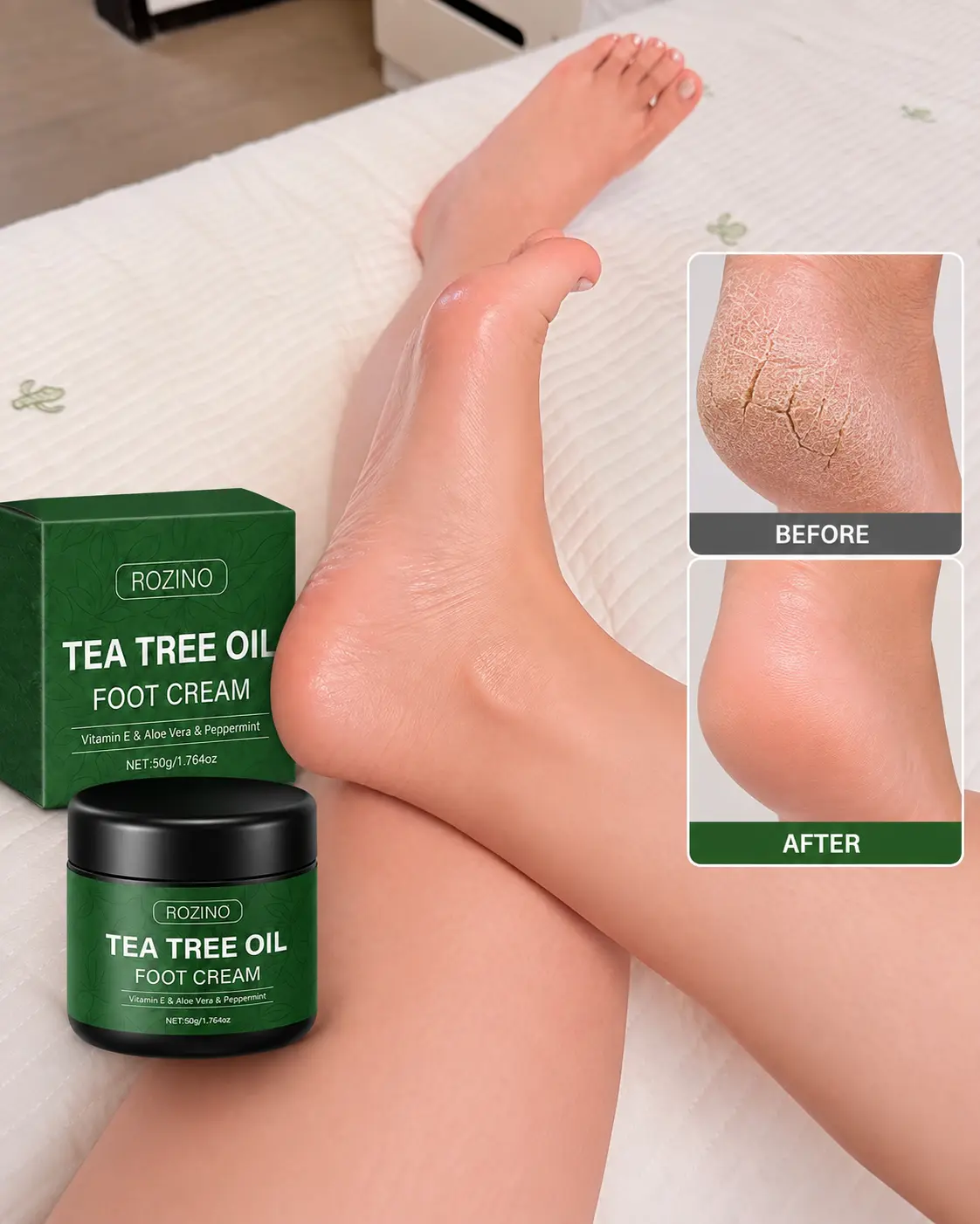 2 bottles ROZINO Tea Tree Foot Cream, Moisturizing Foot Care with Aloe Vera, Peppermint & Vitamin E for Dry Rough Feet, 50g