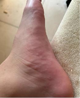 Item: 1-pack(For Trial)