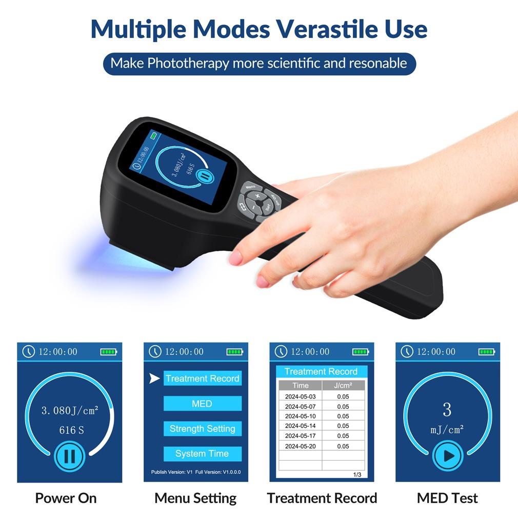 ZJZK 308nm Excimer Phototherapy Device with 49 Diodes, Blue Light Therapy for Vitiligo, Psoriasis, Eczema, Atopic Dermatitis, Fungal Skin Disease, Hypopigmentation, Safe Targeted Home Use, Fast Recovery, Prevent Recurrence, Portable Handheld