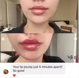 Instant Filler Lip Plumper (3ml)