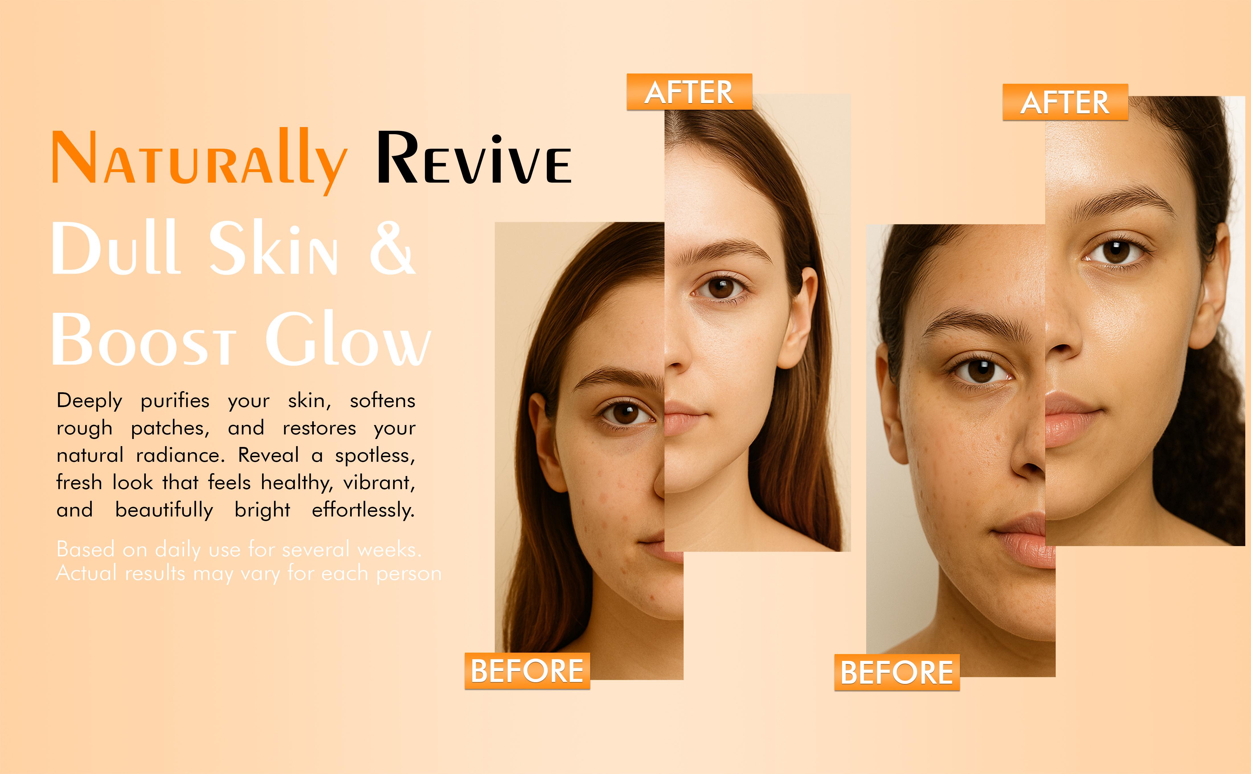 Kojic Acid & Turmeric Dark Spot Corrector Soap Bar With Vitamin C Hyaluronic Acid, Shea Butter & Rosehip Oil, Original Korean Kojic Complex Balancing Cleanser for All Skin Types