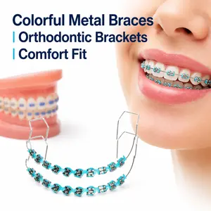 1 Pair Fashion Braces Colorful Temporary Tooth Decoration with Metal Wires Metal Bracket Orthodontic Ligature Ties High Quality