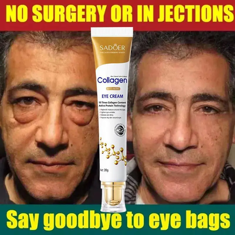 Collagen Eye Cream – Dark Circles Treatment, Anti-Aging, Instant Puffiness Reduction, Fine Line Fading, Skin Firming, Bright Undereye Care (Beauty & Personal Care Skincare Eye Treatment), Drop, Jolly