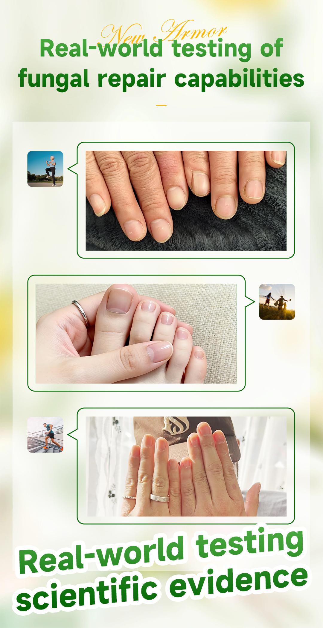 【Special effects】Toenail Fungus Extra Strength,Antifungal Solution for Toenail or Fingernail, Triple ActionFormula for Remove Fungal, Repair and Renewal DamagedNails.