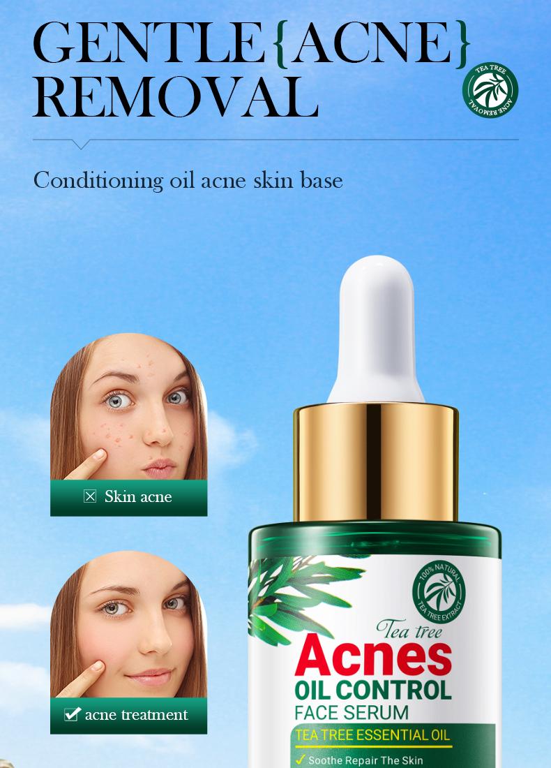 Tea tree acne oil control essence, lightens acne marks, natural cleansing and acne removal, removes blackheads, repairs skin essence