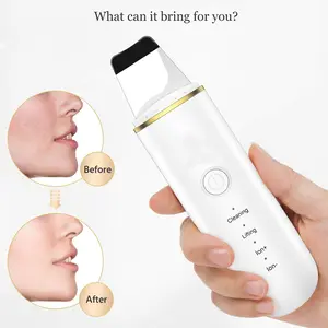 4-in-1 Sonic Skin Spatula: Ion Therapy & Aqua Peeling for Deep Pore Cleansing, Lifting and Blackhead Removal