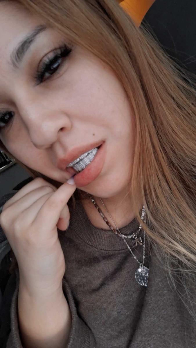 Item: Upper teeth + Lower teeth