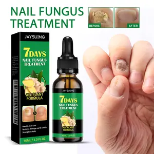 JAYSUING Ginger Nail Treatment | Vitamin E & Plant Essential Oils for Nail Care | Supports Recovery from Onychomycosis, Paronychia, & Nail Deformation | Comforting Manicure & Nail Art Solution Ginger Nail Ginger Nail