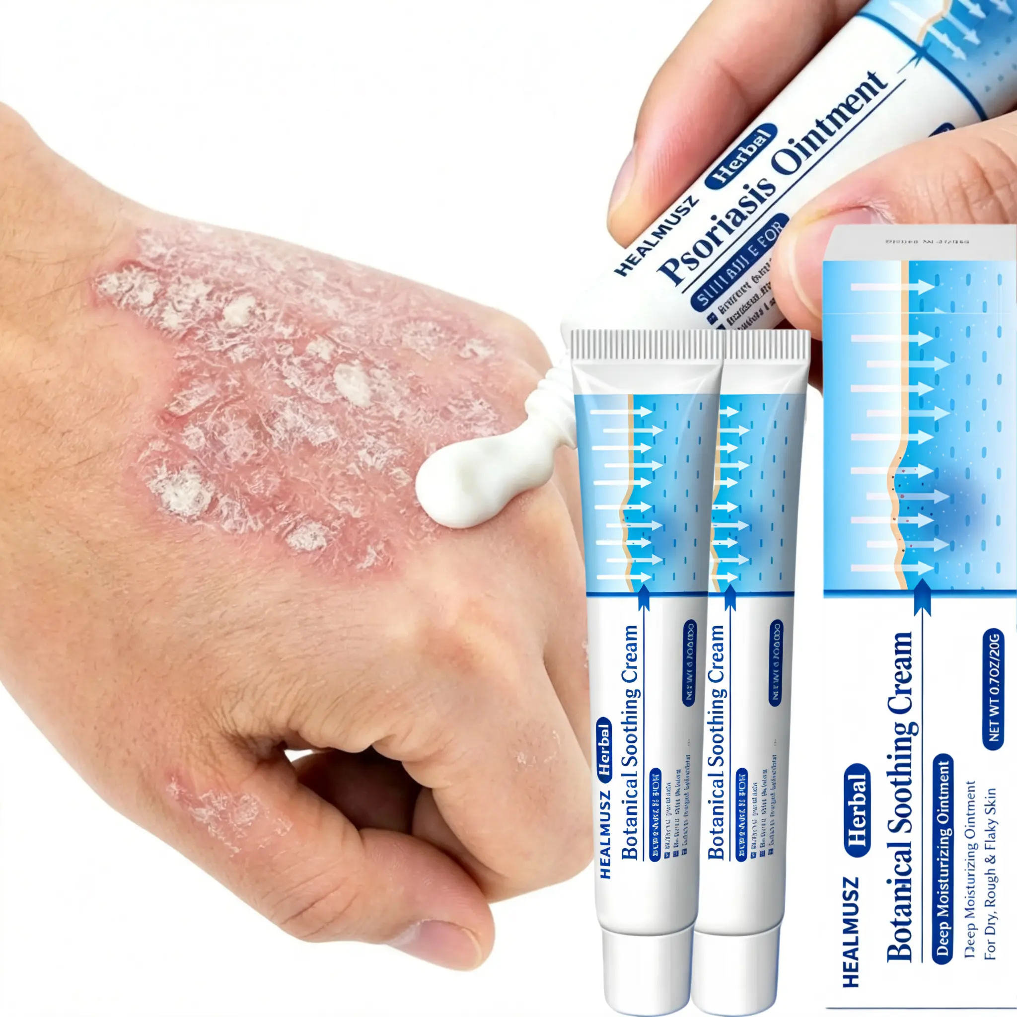 Antifungal & Psoriasis Cream – 100% Natural Plant Formula for Psoriasis, Tinea (Scalp, Body, Groin, Versicolor), Copper Fungus. Fast Relief for Itching, Dryness, Redness. Deep Hydration, Soothing & Non-Recurring– 20g