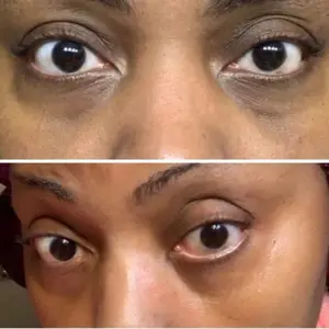 Dark Circle Remover Serum 15ml