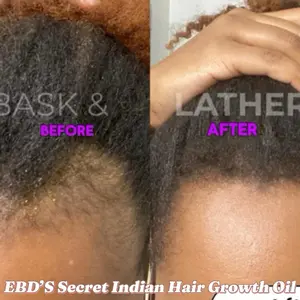 EBD’s Secret Indian Hair Growth Oil - Haircare Treatment for Enhanced Comfort and Growth
