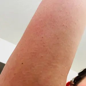 Soft-Touch Body Mask: 30% glycolic acid , 2% salicylic acid - exfoliating body mask Body Care Hydrating