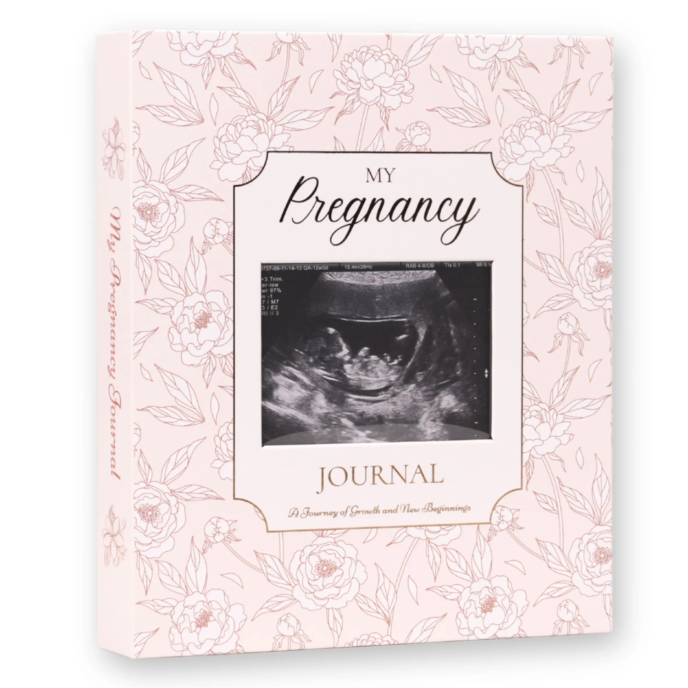 Pregnancy Journal and Notebook for First Time Moms, Pregnancy Planner with 12 Monthly Calendars, Weekly Tracker, Photo Pages & Back Pocket, Baby Journal Memory Book Keepsake – Thoughtful Mom-to-Be Gift