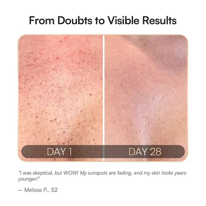 INIA GLOW Neck & Chest Red Light Mask – 850nm NIR LED Mask for Wrinkle & Spot Reduction, Lift & Firm in 4 Weeks, Rechargeable 2600mAh Controller, Clinic-Grade Full Coverage, Best Valentine's Day Gift for Her 2