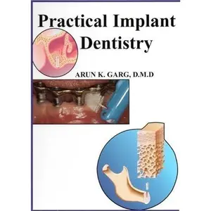 USED-Practical Implant Dentistry by DMD Arun K. Garg (Hardcover)