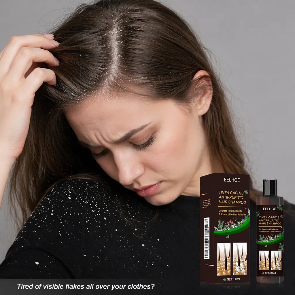 Hair Care Shampoo Oil Control Refreshing Anti-Dandruff Anti-itch Scalp Cleansing Shampoo