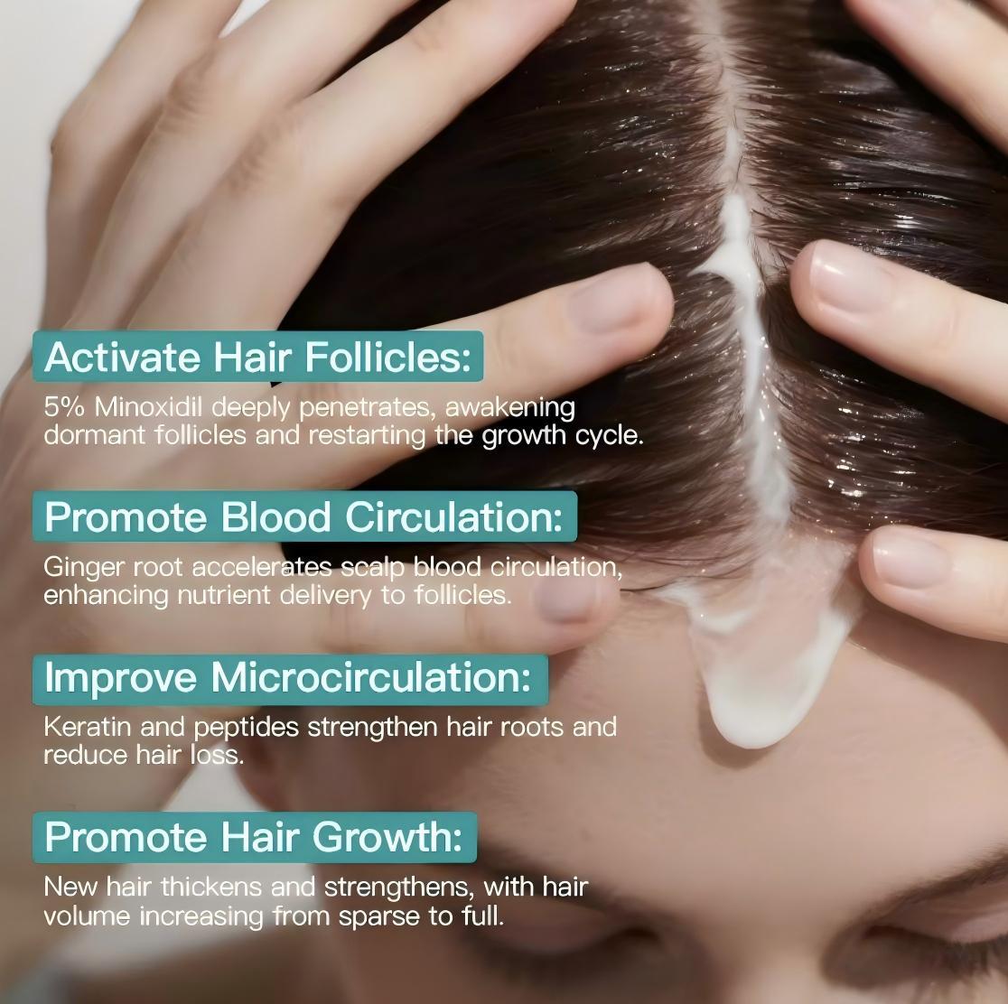 【Buy 1 Get 1 Free】5% Minoxidil Hair Growth Scalp Massage Cream with Keratin & Ginger for Men Women Prevents Loss Repairs Follicles Promotes Fast Regrowth Strengthens Roots Buy 1 Get 1 Free 【Buy 1 Get 1 Free】5% Minoxidil Hair Growth Scalp Massage Cream with Keratin & Ginger for Men Women Prevents Loss Repairs Follicles Promotes Fast Regrowth Strengthens Roots Buy 1 Get 1 Free