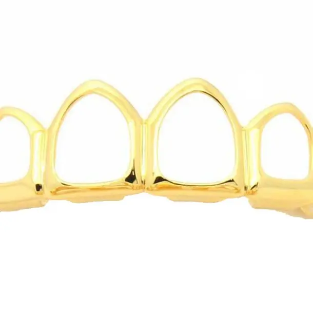 Gold hollowing (upper teeth)