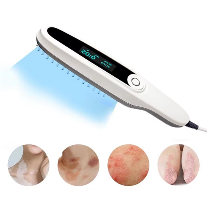 UVB 311nm Phototherapy Lamp Handheld Light Therapy Device for Vitiligo